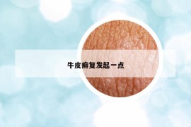 牛皮癣复发起一点