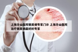 上海华山医院银屑病专家门诊 上海华山医院治疗银屑病最好的专家