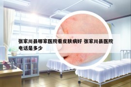 张家川县哪家医院看皮肤病好 张家川县医院电话是多少