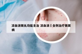 凉血消银丸功能主治 凉血消疕合剂治疗银屑病
