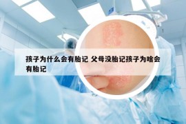孩子为什么会有胎记 父母没胎记孩子为啥会有胎记