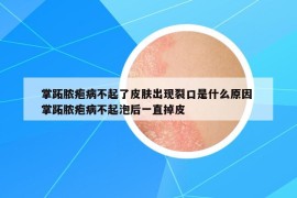 掌跖脓疱病不起了皮肤出现裂口是什么原因 掌跖脓疱病不起泡后一直掉皮