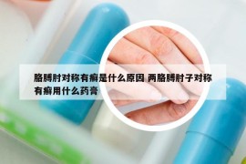 胳膊肘对称有癣是什么原因 两胳膊肘子对称有癣用什么药膏