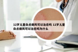 12岁儿童白点癫风可以治愈吗 12岁儿童白点癫风可以治愈吗为什么