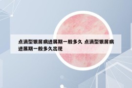 点滴型银屑病进展期一般多久 点滴型银屑病进展期一般多久出现