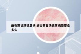 麻杏薏甘汤银屑病 麻杏薏甘汤银屑病需要吃多久