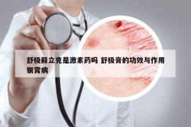 舒极藓立克是激素药吗 舒极膏的功效与作用银霄病