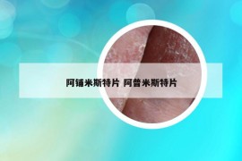 阿铺米斯特片 阿普米斯特片