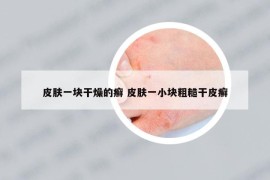 皮肤一块干燥的癣 皮肤一小块粗糙干皮癣