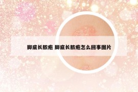 脚底长脓疱 脚底长脓疱怎么回事图片