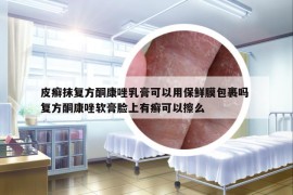 皮癣抹复方酮康唑乳膏可以用保鲜膜包裹吗 复方酮康唑软膏脸上有癣可以擦么