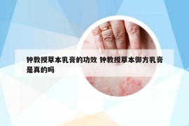 钟教授草本乳膏的功效 钟教授草本御方乳膏是真的吗