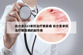 白介素il23单抗治疗银屑病 白介素单抗治疗银屑病的副作用