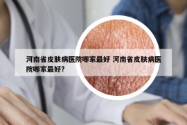 河南省皮肤病医院哪家最好 河南省皮肤病医院哪家最好?