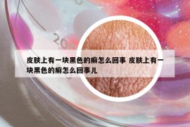 皮肤上有一块黑色的癣怎么回事 皮肤上有一块黑色的癣怎么回事儿