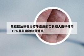 黑豆馏油软膏治疗牛皮癣能否长期大面积使用 10%黑豆馏油软膏外用