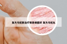 复方乌蛇散治疗银屑病最好 复方乌蛇丸