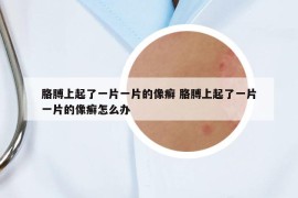 胳膊上起了一片一片的像癣 胳膊上起了一片一片的像癣怎么办