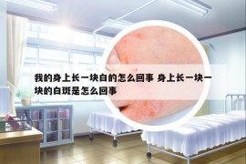 我的身上长一块白的怎么回事 身上长一块一块的白斑是怎么回事