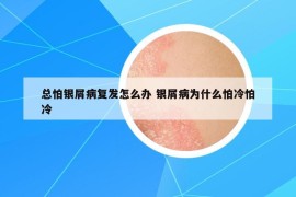 总怕银屑病复发怎么办 银屑病为什么怕冷怕冷
