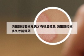 消银颗粒要吃几天才有明显效果 消银颗粒吃多久才能停药