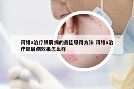 阿维a治疗银屑病的最佳服用方法 阿维a治疗银屑病效果怎么样