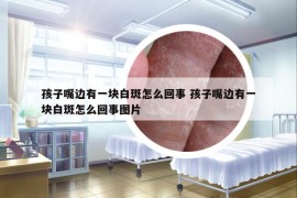 孩子嘴边有一块白斑怎么回事 孩子嘴边有一块白斑怎么回事图片