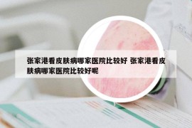 张家港看皮肤病哪家医院比较好 张家港看皮肤病哪家医院比较好呢