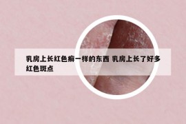 乳房上长红色癣一样的东西 乳房上长了好多红色斑点