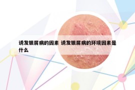 诱发银屑病的因素 诱发银屑病的环境因素是什么