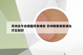 苏州去牛皮癣医院有哪些 苏州哪里银屑病治疗比较好
