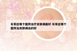 石家庄哪个医院治疗皮肤病最好 石家庄哪个医院治皮肤病治的好