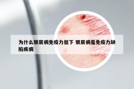 为什么银屑病免疫力低下 银屑病是免疫力缺陷疾病