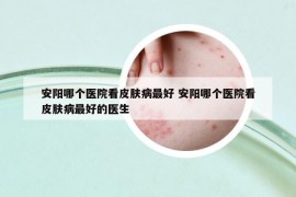 安阳哪个医院看皮肤病最好 安阳哪个医院看皮肤病最好的医生