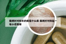 胳膊肘对称长的癣是什么癣 胳膊肘对称起一堆小疙瘩痒