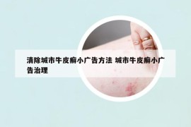 清除城市牛皮癣小广告方法 城市牛皮癣小广告治理