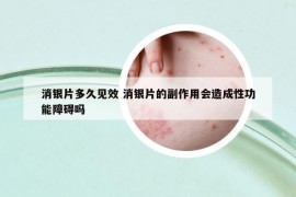 消银片多久见效 消银片的副作用会造成性功能障碍吗