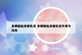 多磺酸粘多糖乳膏 多磺酸粘多糖乳膏作用与功效