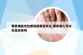 银屑病能吃牡蛎肽胶原蛋白么 银屑病人可以吃蛋白粉吗
