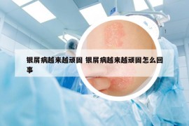 银屑病越来越顽固 银屑病越来越顽固怎么回事