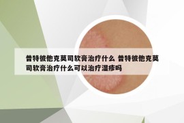 普特彼他克莫司软膏治疗什么 普特彼他克莫司软膏治疗什么可以治疗湿疹吗
