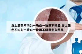 身上颜色不均匀一块白一块黑不明显 身上颜色不均匀一块白一块黑不明显怎么回事
