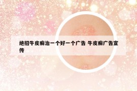 绝招牛皮癣治一个好一个广告 牛皮癣广告宣传