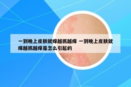 一到晚上皮肤就痒越抓越痒 一到晚上皮肤就痒越抓越痒是怎么引起的