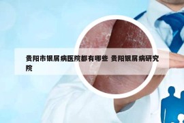 贵阳市银屑病医院都有哪些 贵阳银屑病研究院