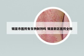 锡盟市医院有生物制剂吗 锡盟新区医院全称