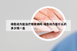 绿色动力能治疗银屑病吗 绿色动力是什么药多少钱一盒