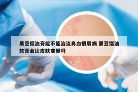 黑豆馏油膏能不能治流鼻血银屑病 黑豆馏油软膏会让皮肤变黑吗