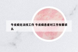 牛皮癣无法找工作 牛皮癣患者对工作有要求么