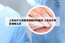 上海治疗小孩银屑病最好的医院 上海治疗银屑病哪儿好